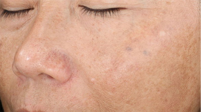 SkinMedica Vitalize Before and After