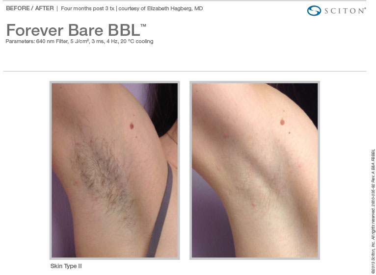 BA Photos FBBBL Binder