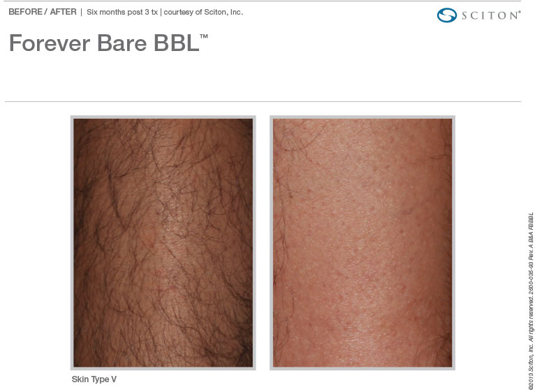 BA Photos FBBBL Binder