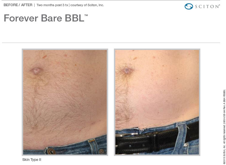 BA Photos FBBBL Binder