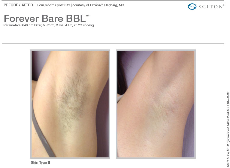 BA Photos FBBBL Binder